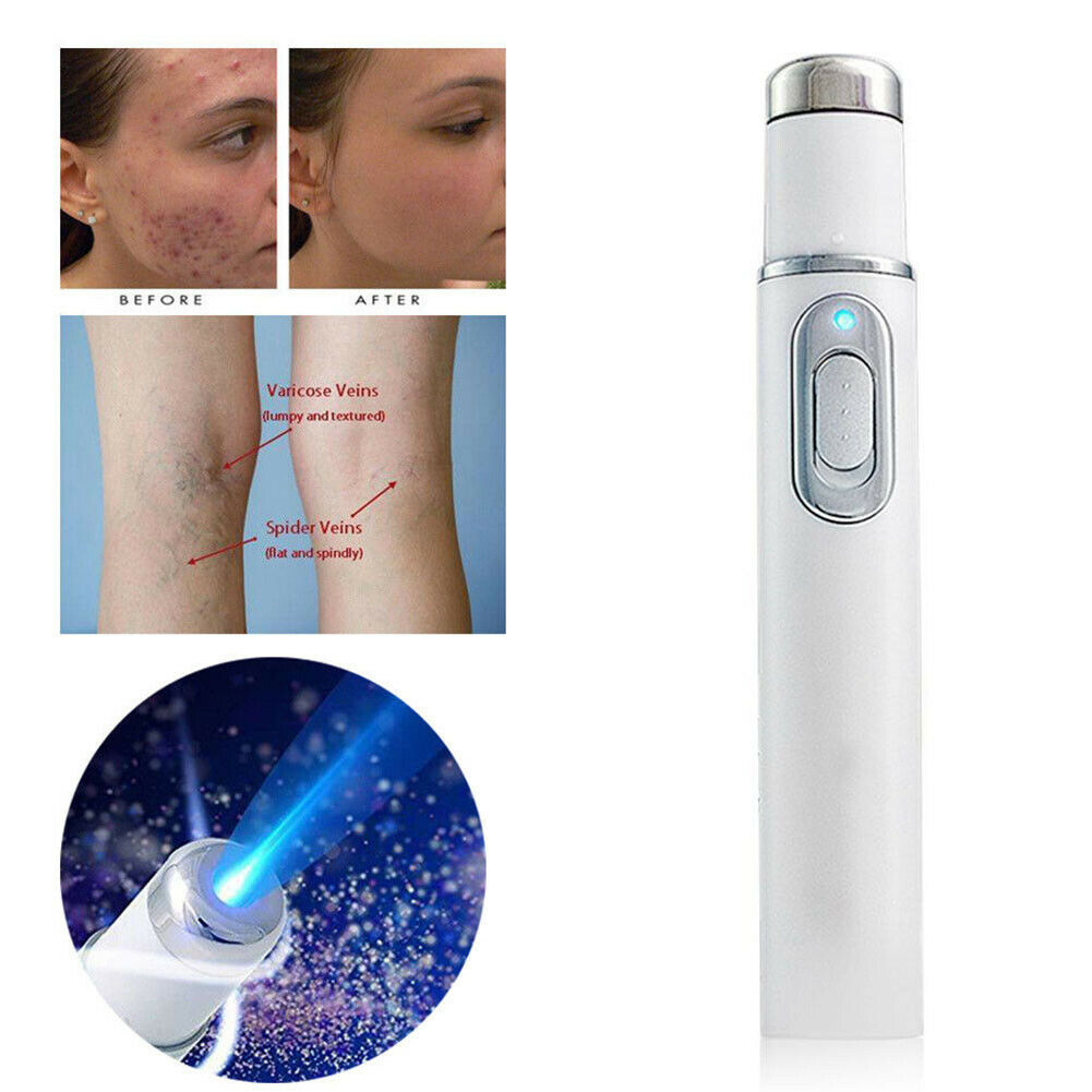 Magical Skin Spots Removal PenSkincares-l1600-2